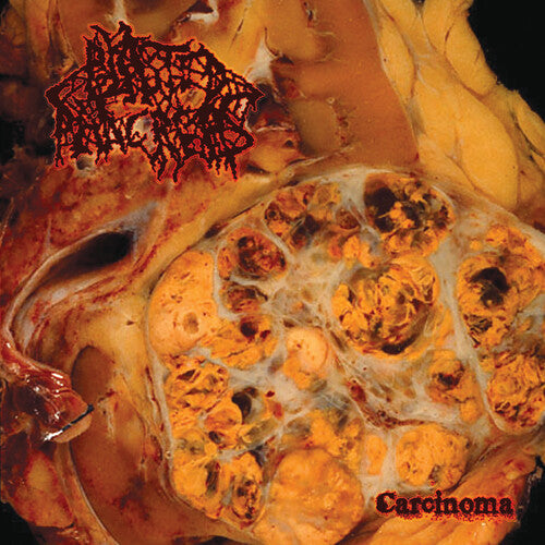 Blasted Pancreas: Carcinoma - VINYL LP